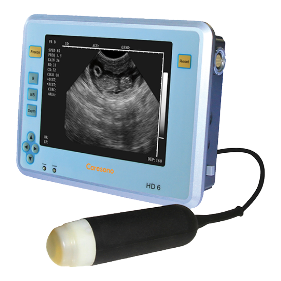 Ultraschallgerät HD 6 Scan